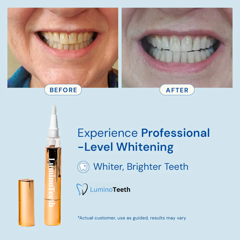 Lumino Teeth™ Whitening Serum